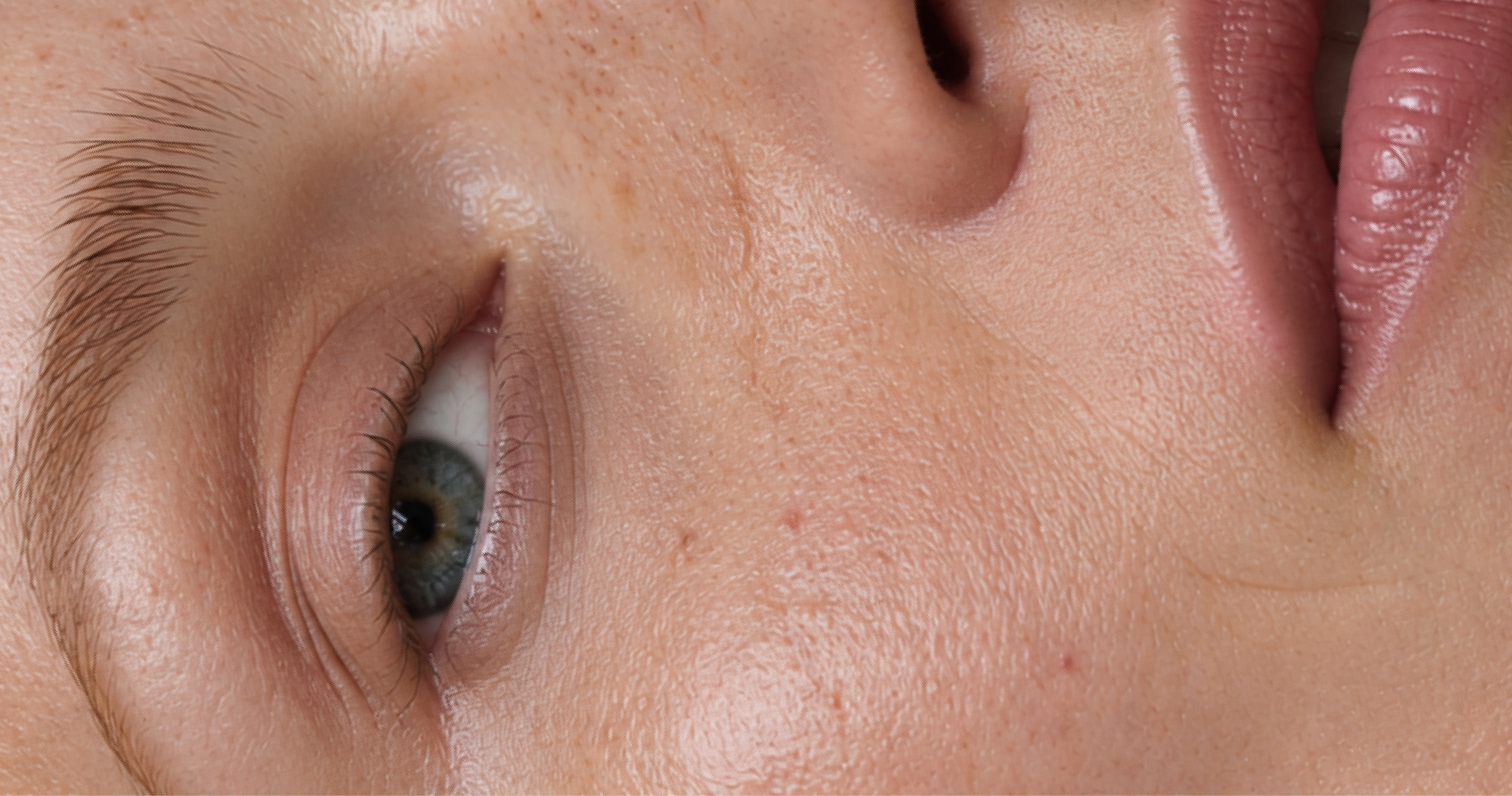 The Relationship Between Skincare and Filler: Where Each Fits