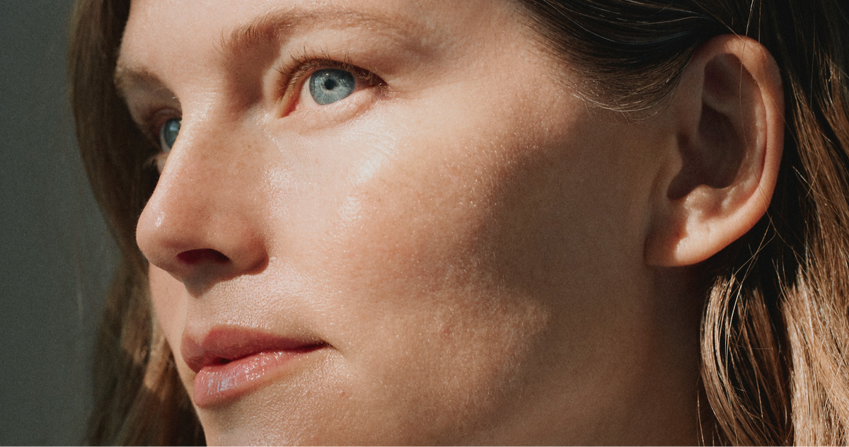 What Is Skin Quality? Why It Matters If You Get Botox, Filler, or Lasers