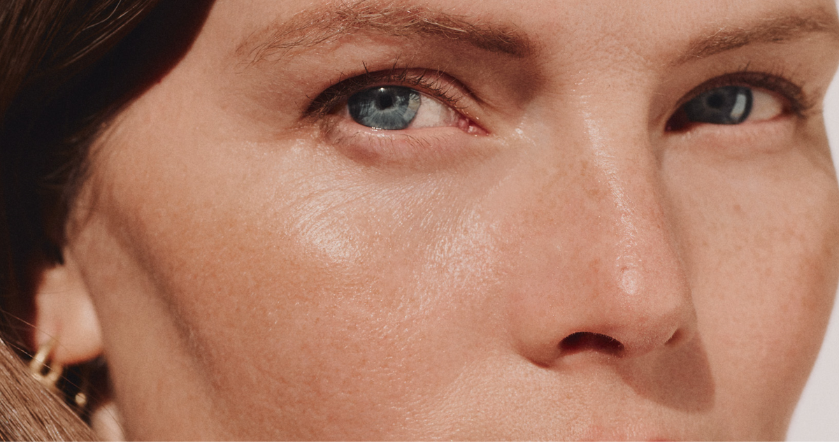 Why the Eye Area Needs Targeted Care (Especially If You Get Botox or Filler)