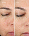 Before and after of woman's face showing smoother skin and reduced fine lines after using Dr. Marnie's Essential Collection