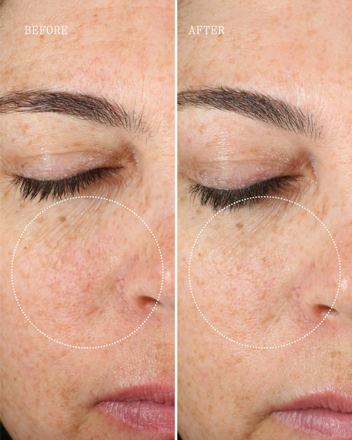 Before and after of woman's face showing smoother skin and reduced fine lines after using Dr. Marnie's Essential Collection