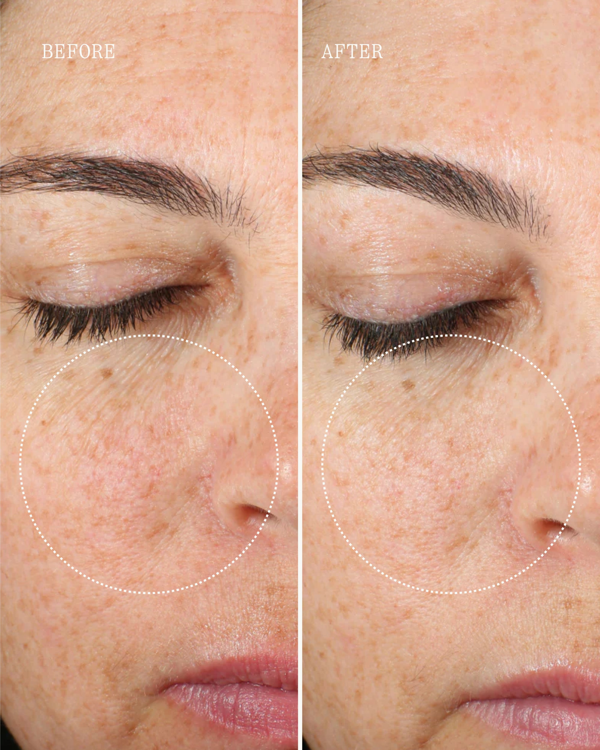 Before and after of woman's face showing smoother skin and reduced fine lines after using Dr. Marnie's Essential Collection