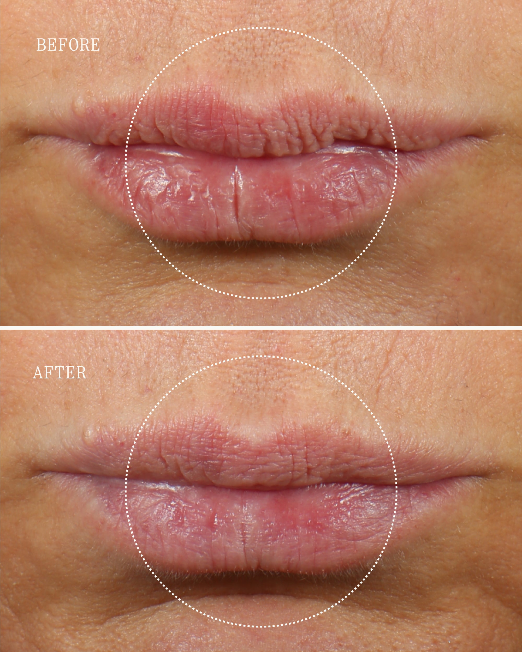 Lip Plump & Glow Trio