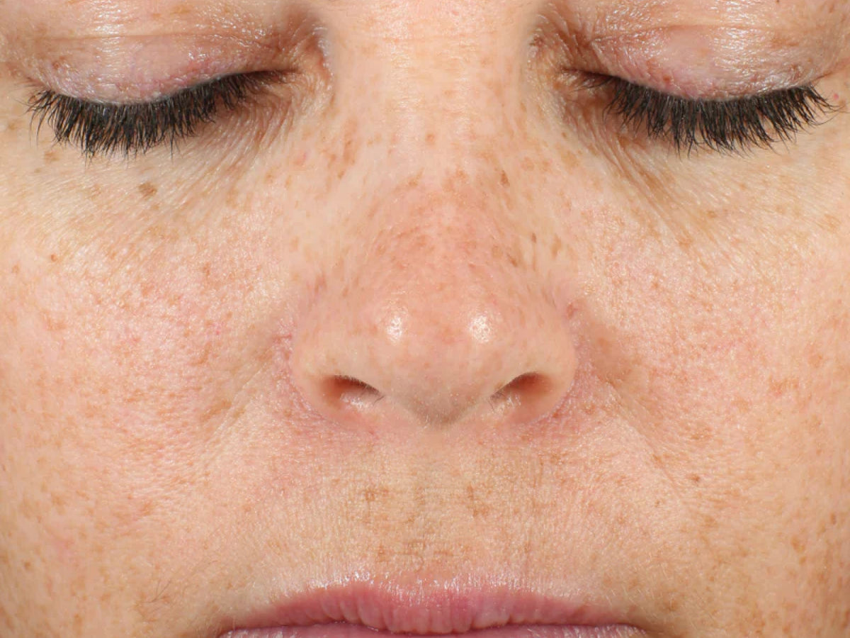 Facial Serum clinical study, After 4 weeks — after