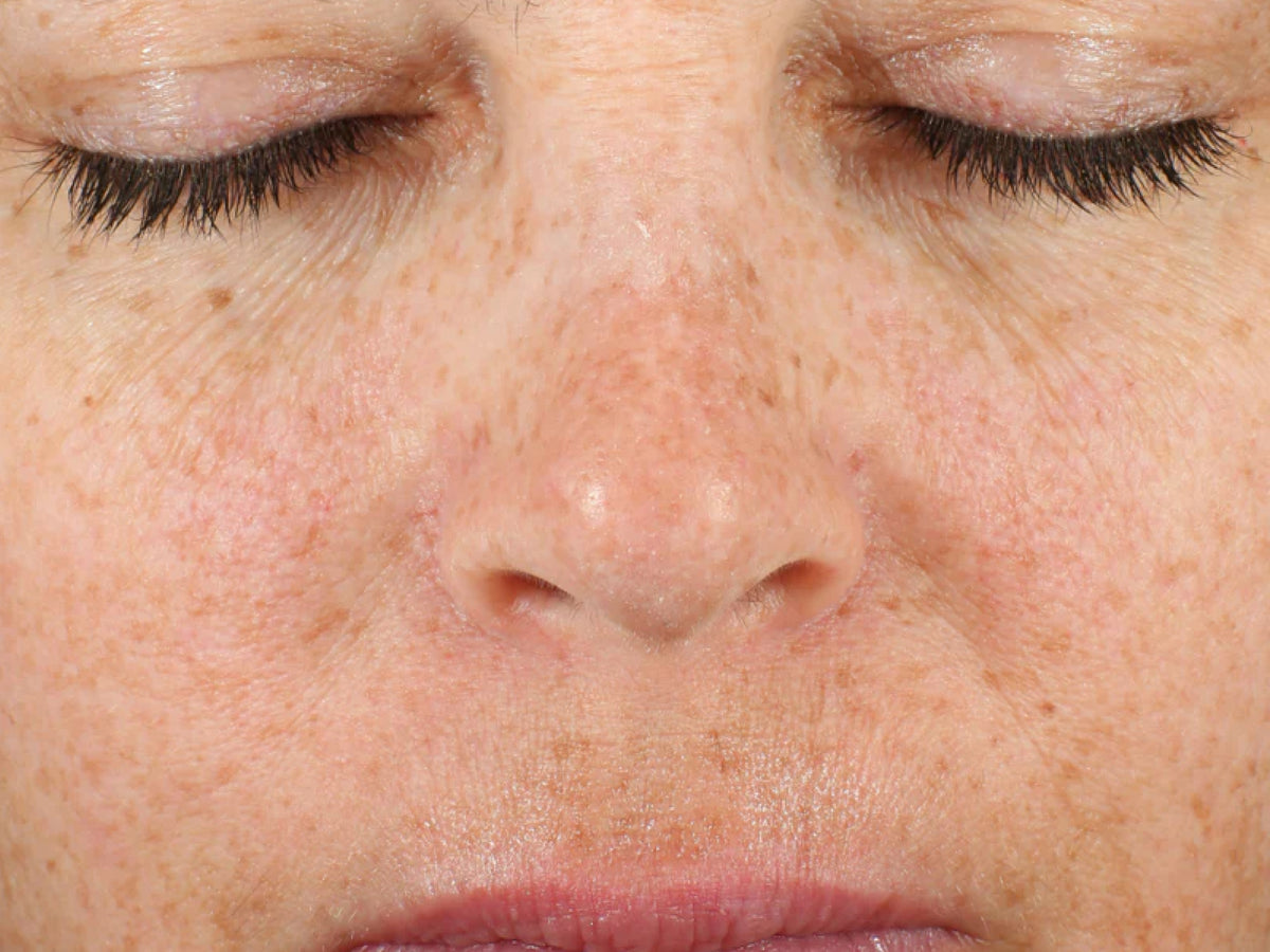 Facial Serum clinical study, After 4 weeks — before