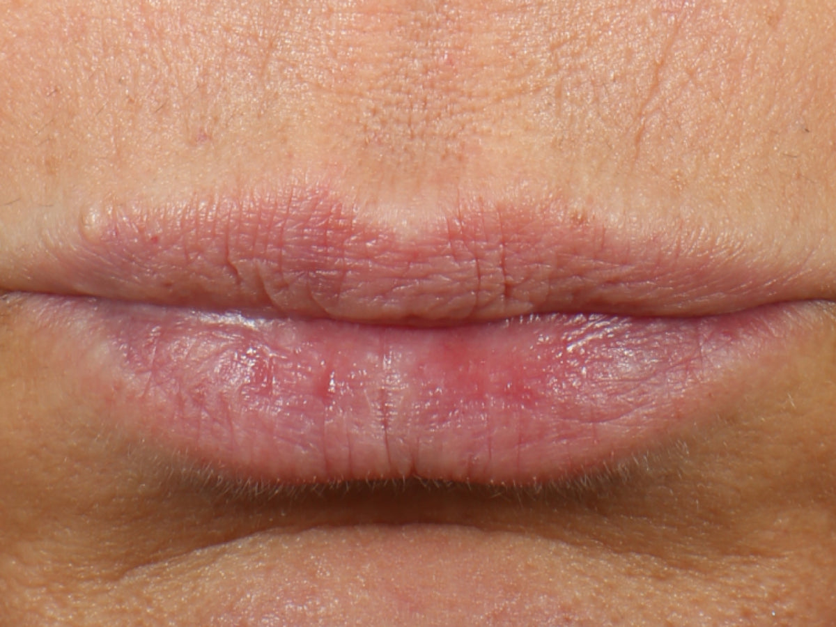 Lip Serum clinical study, After 4 weeks — after
