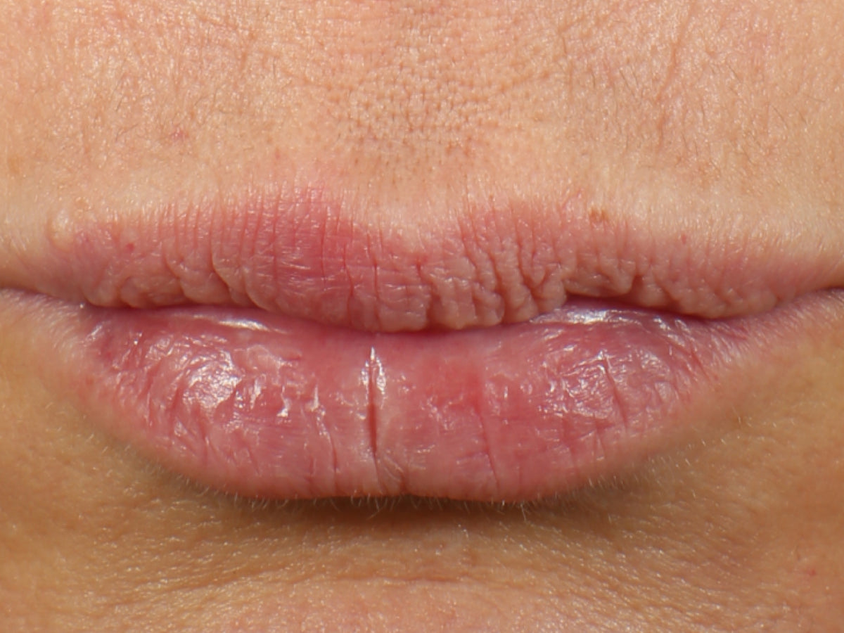 Lip Serum clinical study, After 4 weeks — before