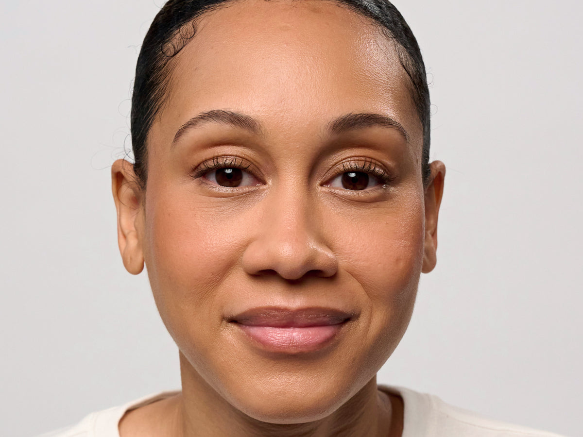 Lip Serum clinical study, Immediate phase — before