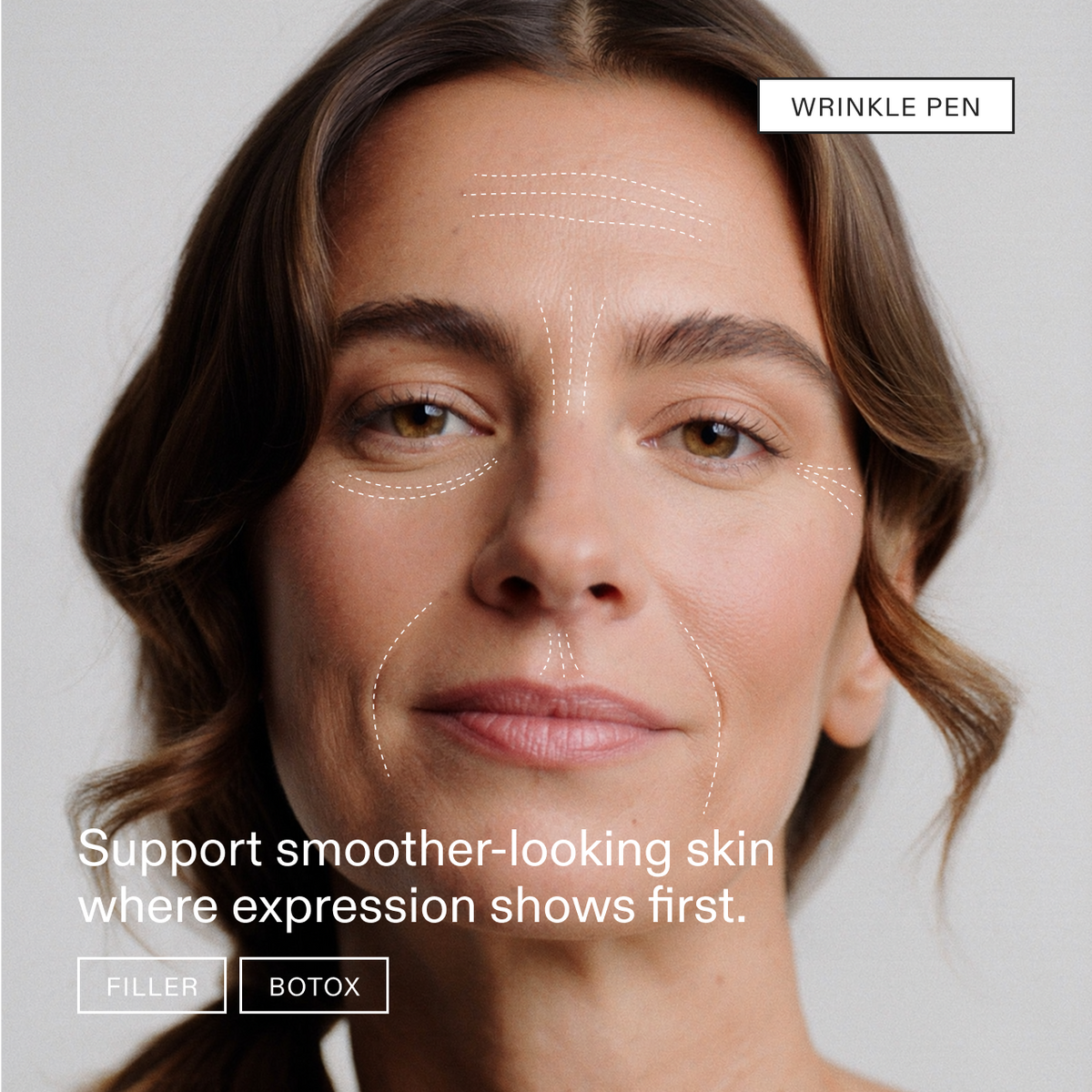 Wrinkle Pen: a model portrait with dotted lines mapping the forehead, 11s, crow's feet and smile lines, tagged Filler and Botox, with the line: Support smoother-looking skin where expression shows first.