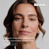 Model portrait with dotted treatment-zone lines mapped over forehead, glabella, under-eyes and smile lines, with a treatment line and FILLER / BOTOX chips at the bottom