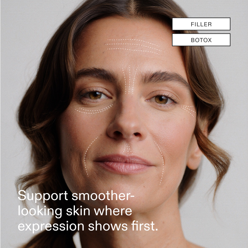 A model portrait with dotted expression-line overlays on forehead, 11s, under-eye and nasolabial areas, FILLER and BOTOX chips top right and a headline bottom left