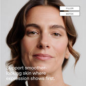 A model portrait with dotted lines mapping the forehead, 11s, crow's feet and smile lines, tagged Filler and Botox, with the line: Support smoother-looking skin where expression shows first.